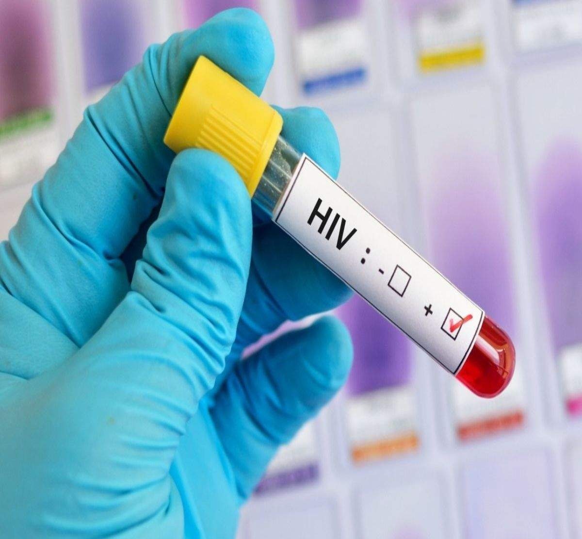 Doctors around the world are raising new hopes for HIV treatment